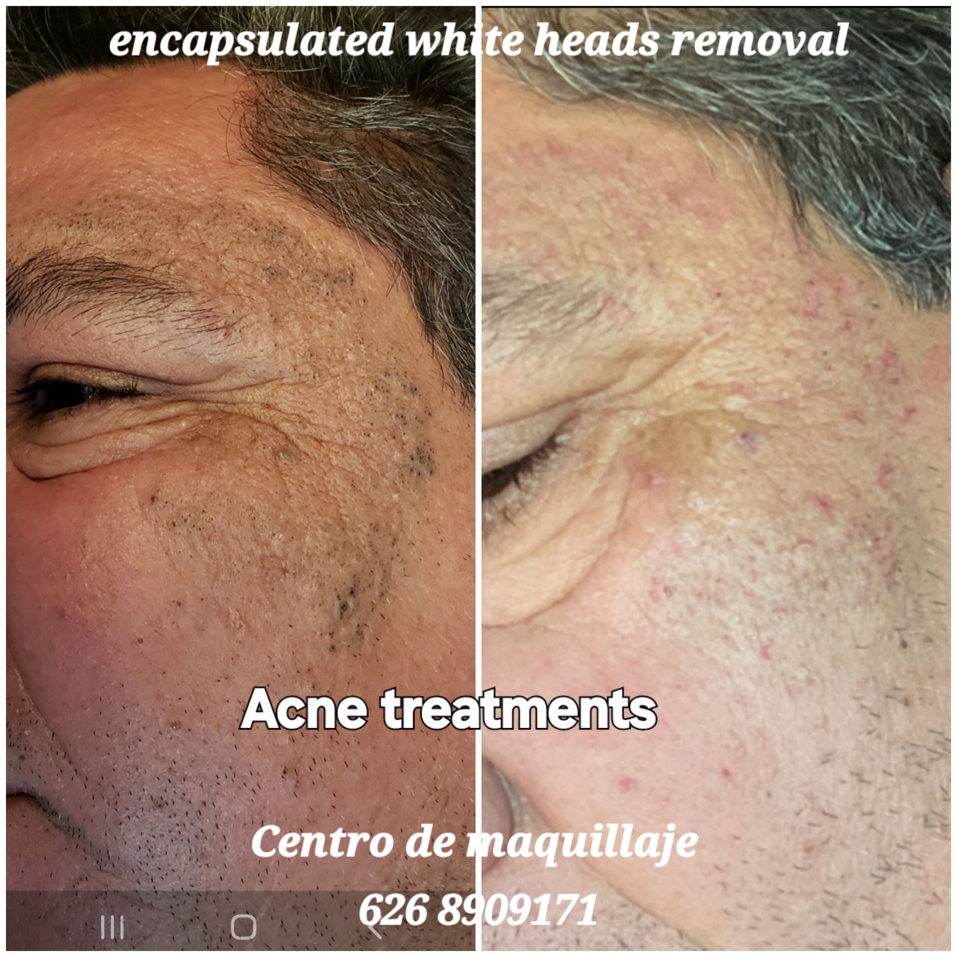 Black impurities removed 